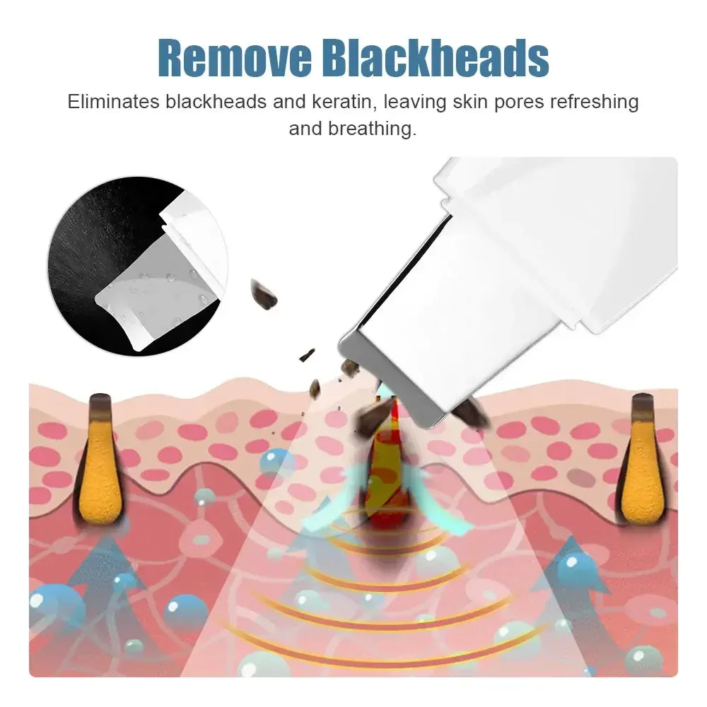 Deep Vibrate Skin Scrubber