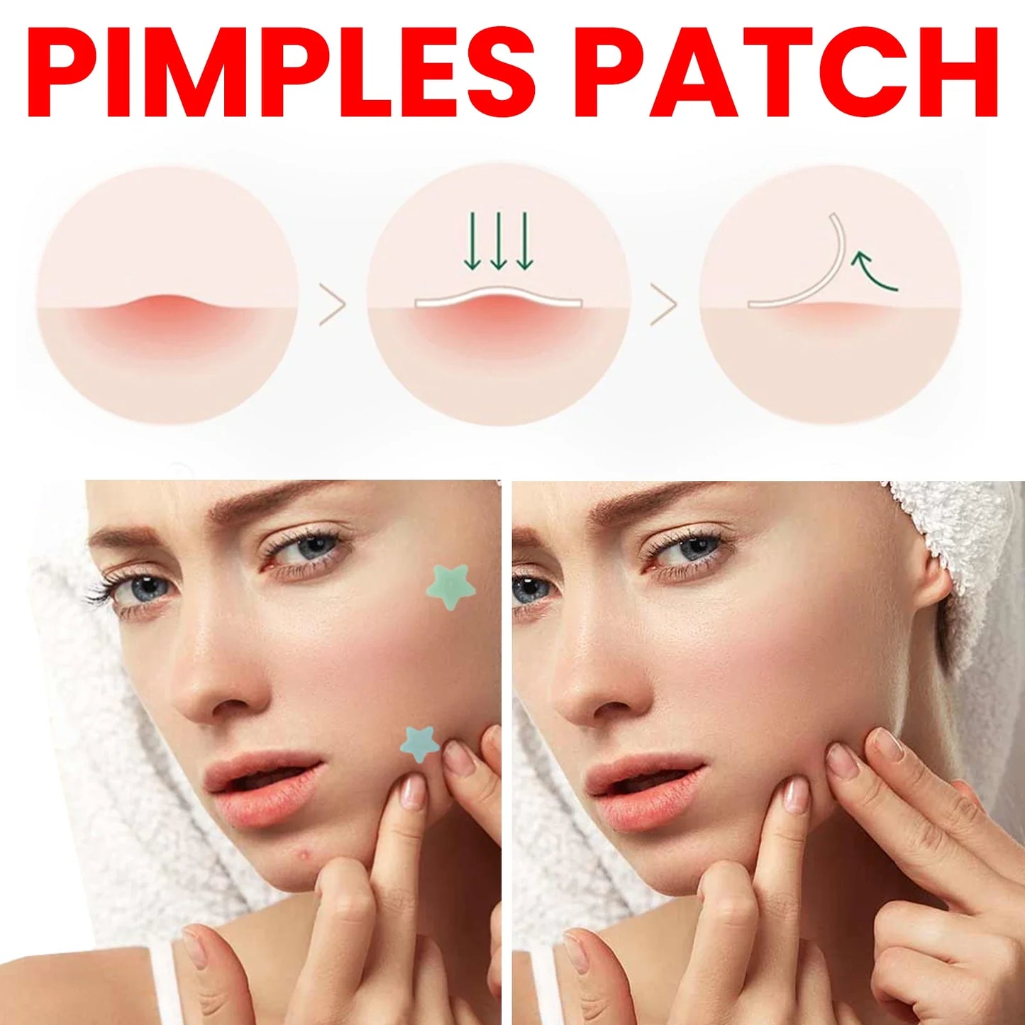 Fade Blemishes Pimple Acne Patch
