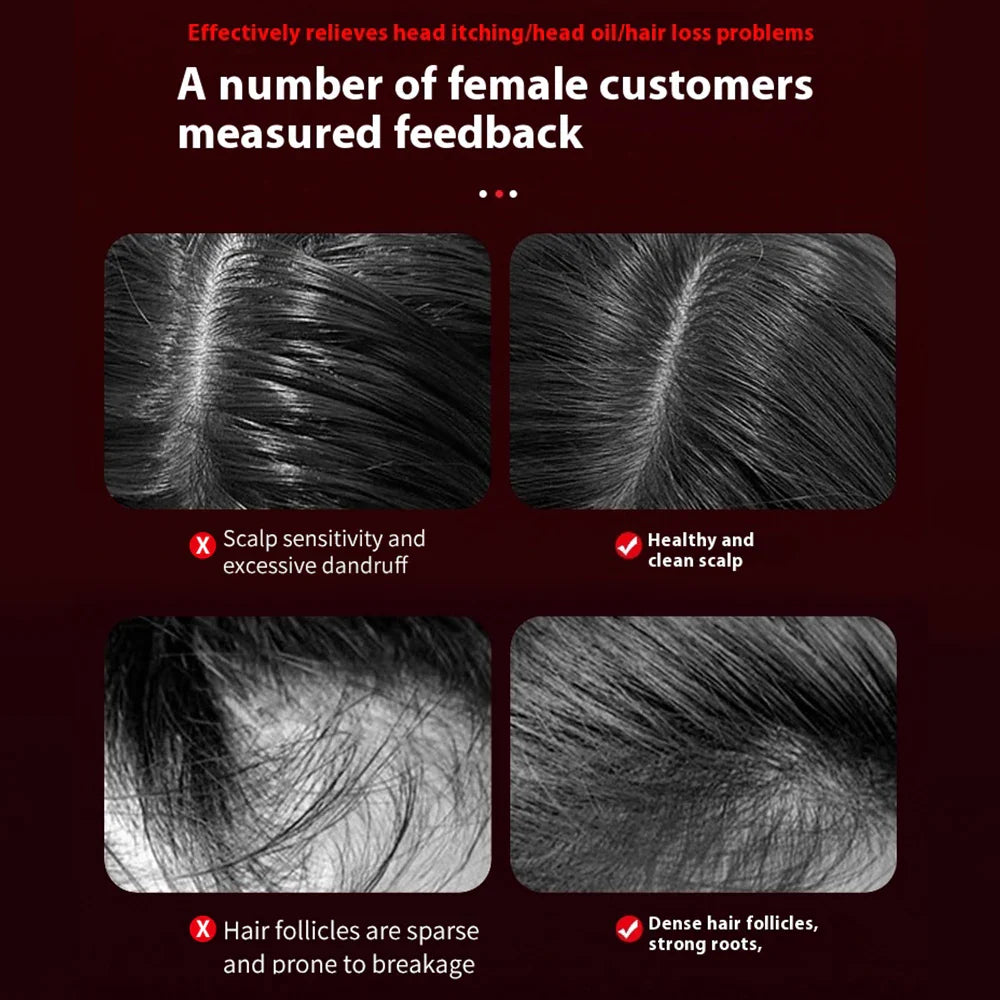 Hair Growth Scalp Massage Comb