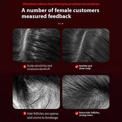 Hair Growth Scalp Massage Comb