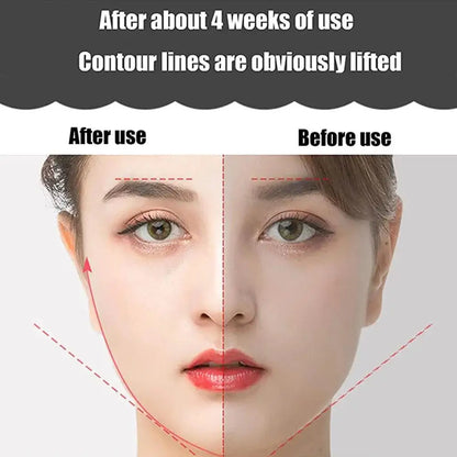 Y Shape Chin Face Lifting Roller