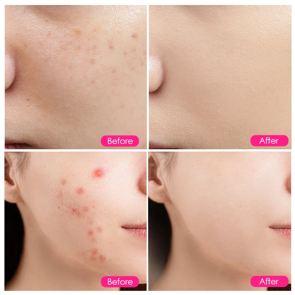 LED Red Light Face Mask Beauty Device